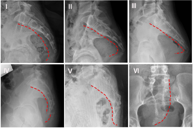 Figure 1