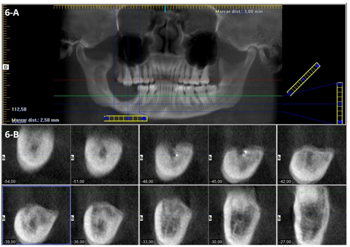Figure 6