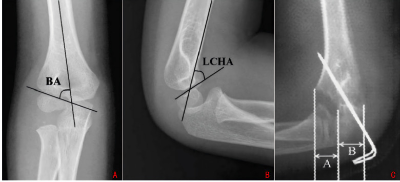 Figure 3