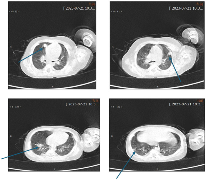 Figure 2