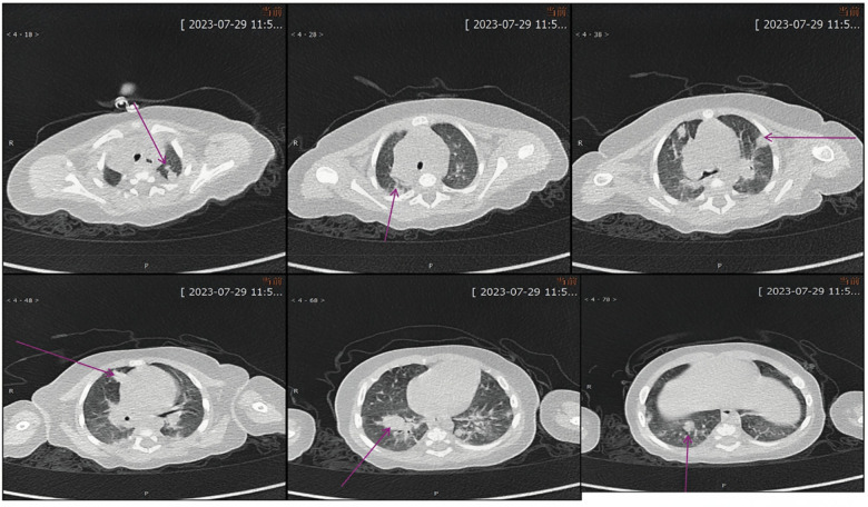 Figure 4