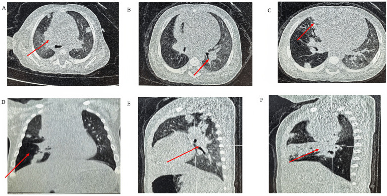 Figure 7