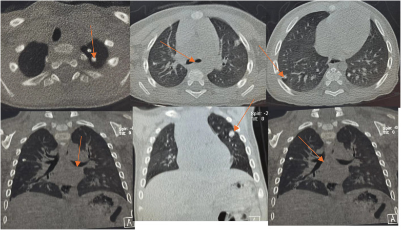 Figure 11