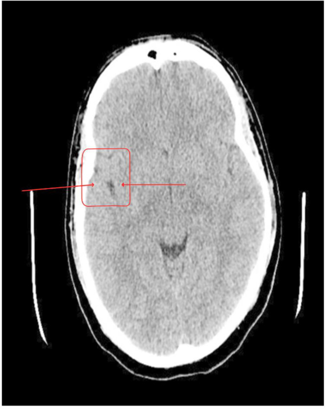 Figure 1