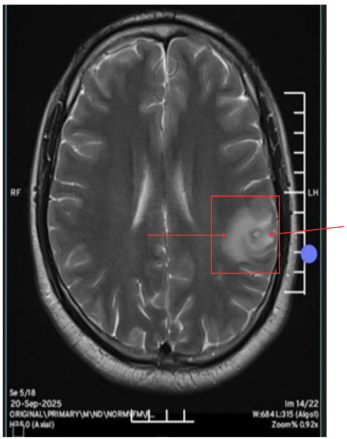 Figure 2