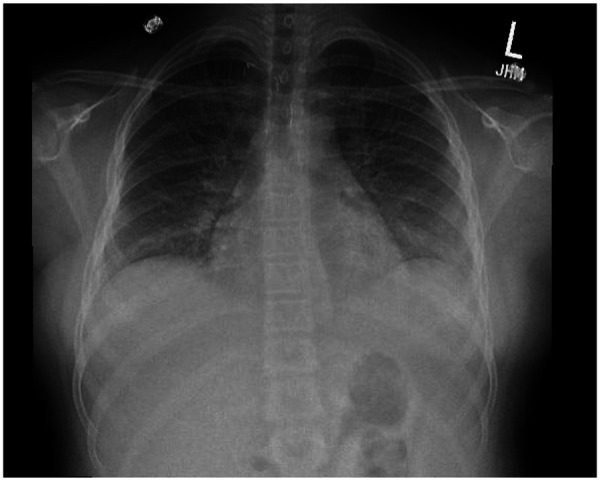 Figure 1