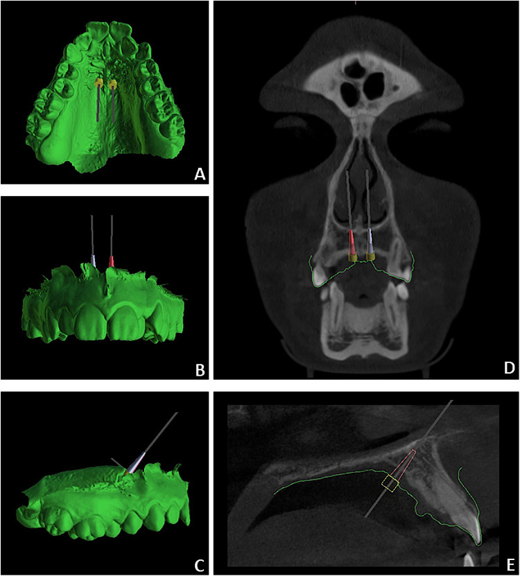 Figure 1