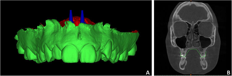 Figure 2