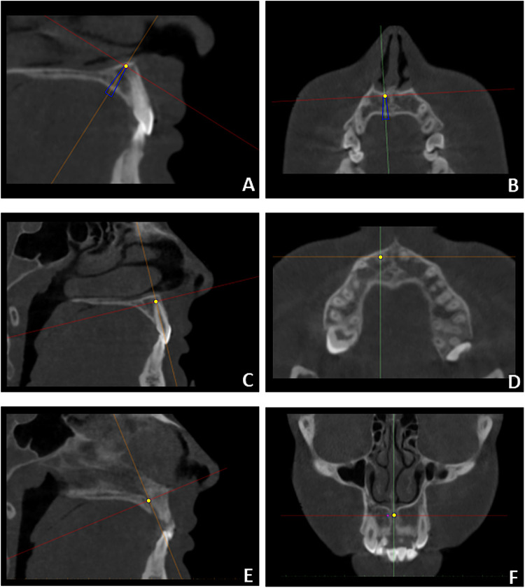 Figure 3