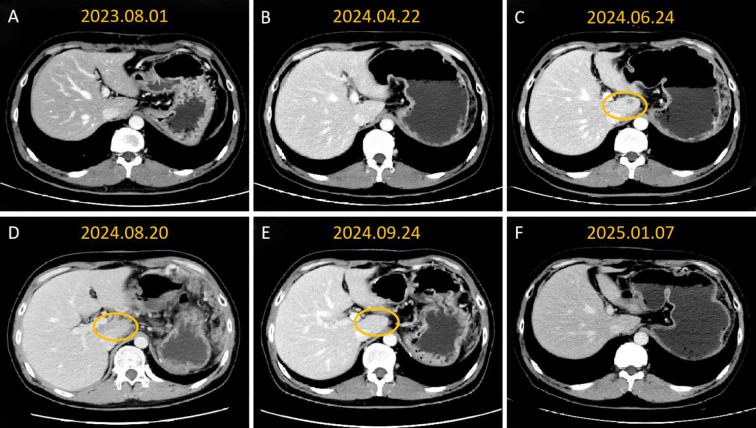 Figure 2