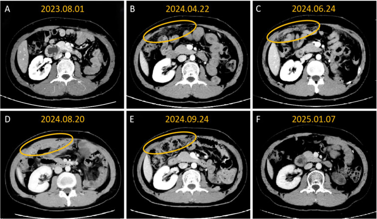 Figure 3
