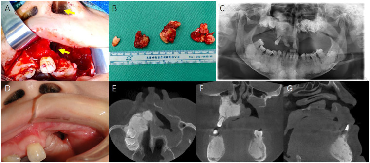 Figure 3