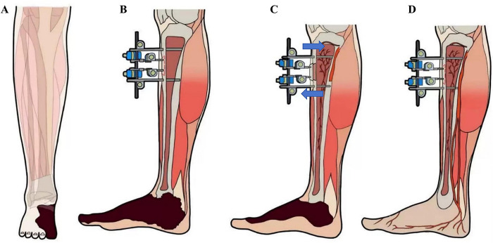 Figure 2