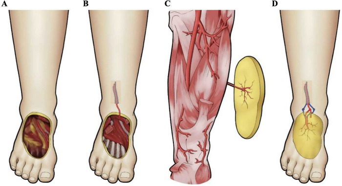 Figure 3