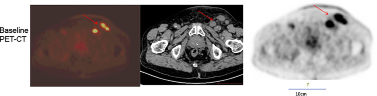 Figure 1