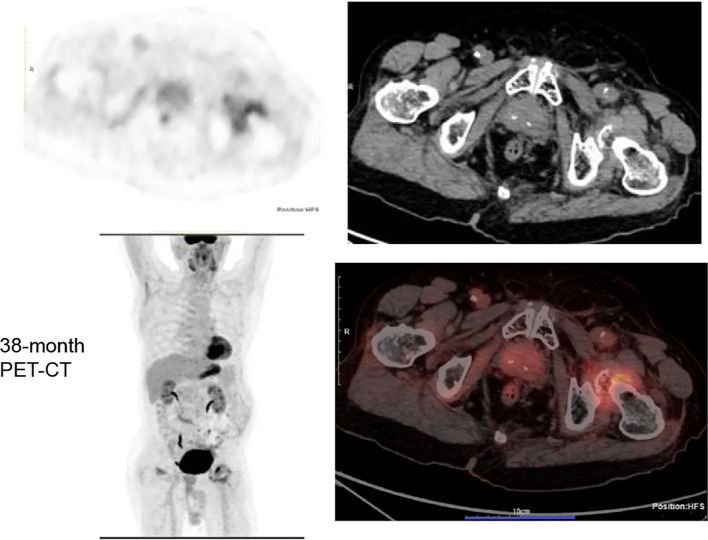Figure 3