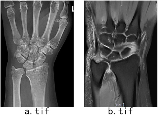Figure 1
