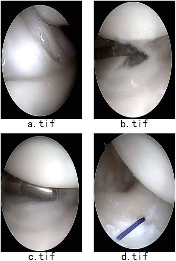 Figure 2