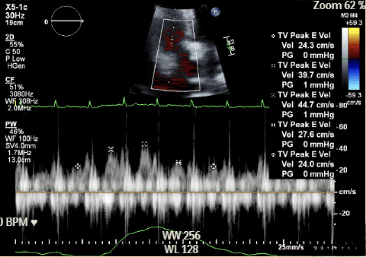 Figure 6