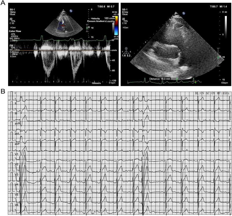 Figure 3