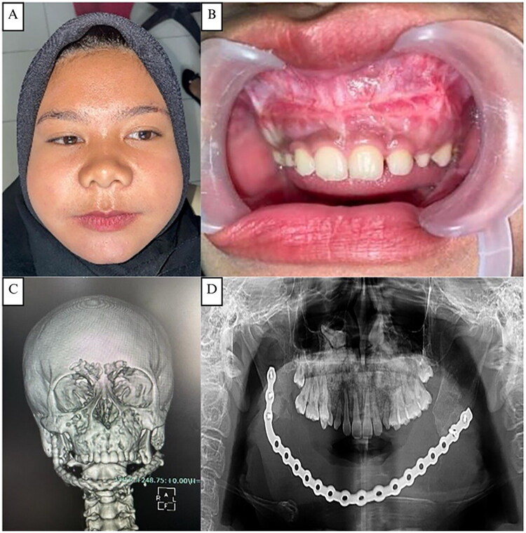 Figure 11