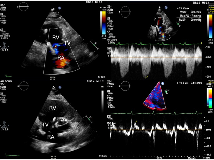 Figure 6