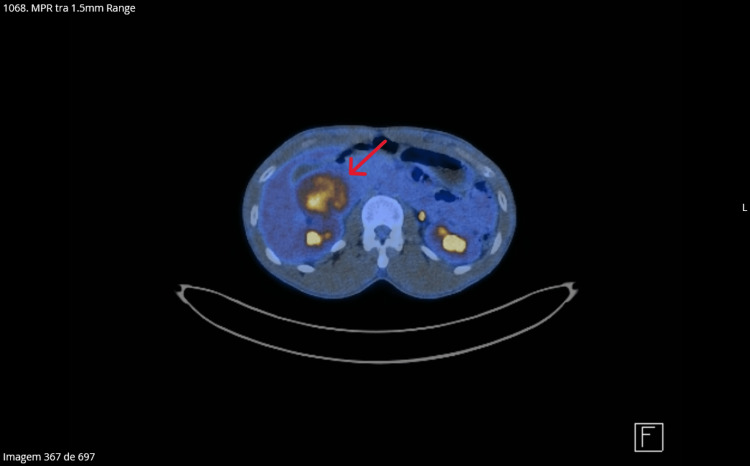 Figure 5