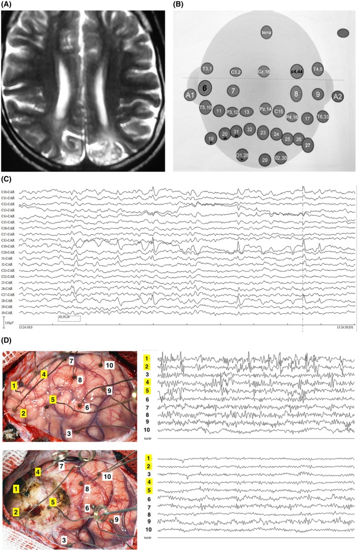 FIGURE 4