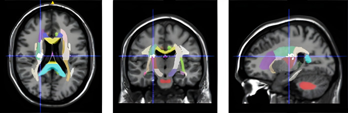 Fig 1