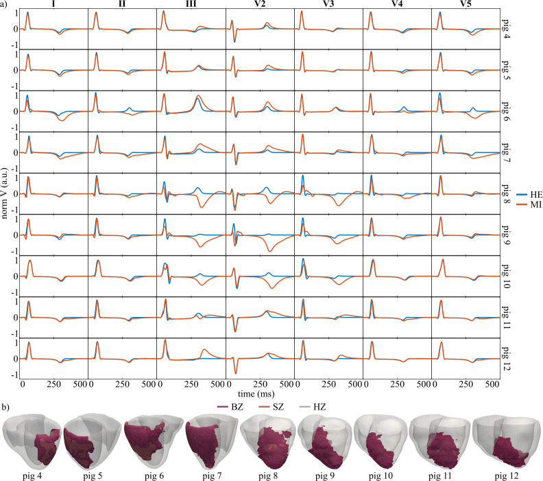 Fig 11
