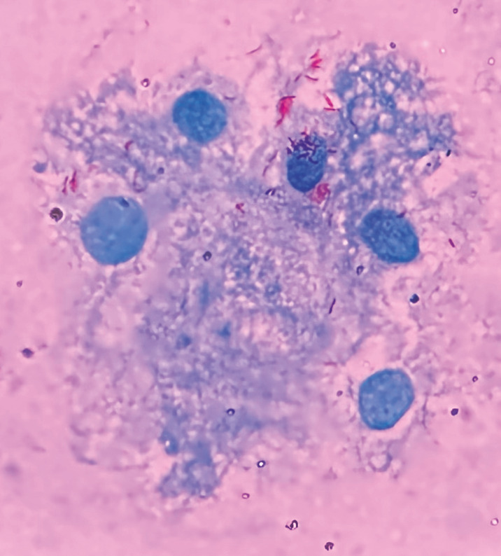 Fig. 2