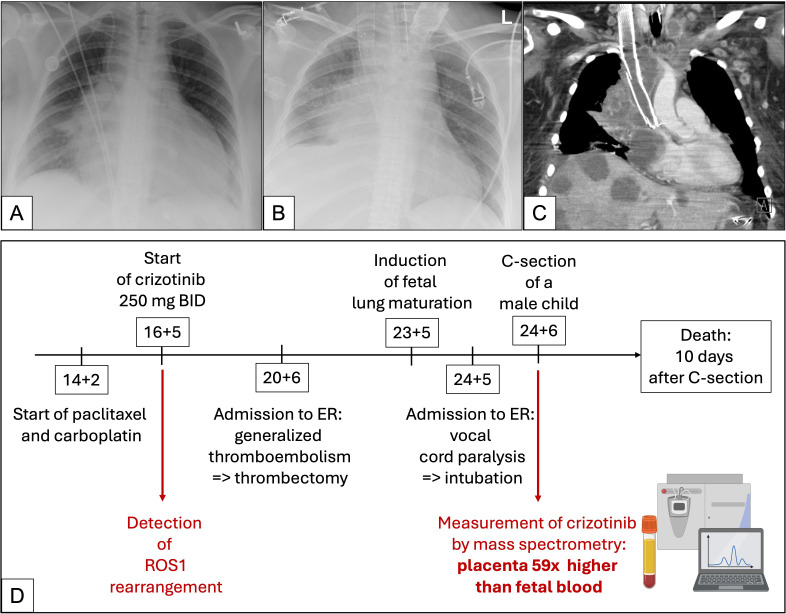 Figure 1