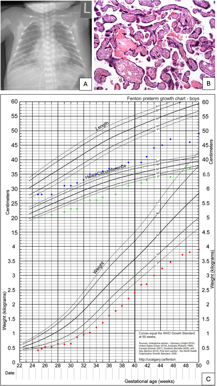 Figure 2