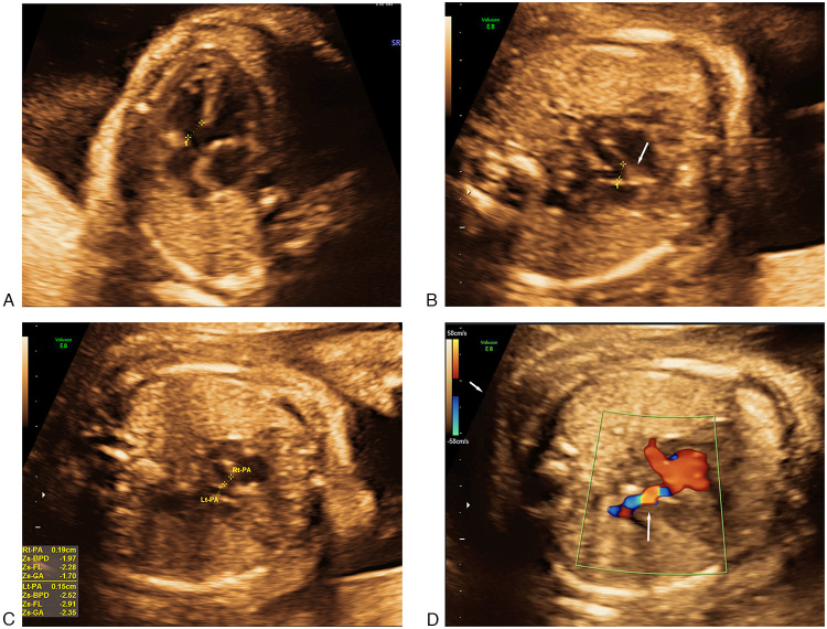 Figure 1