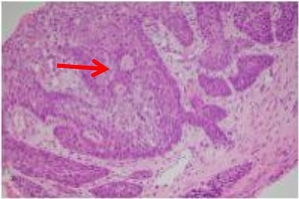 Figure 2