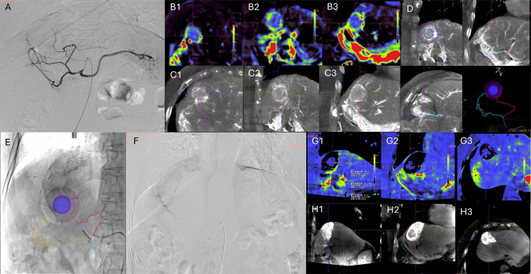 Figure 1