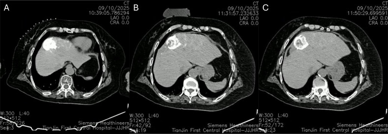 Figure 2