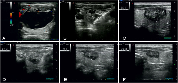Figure 2