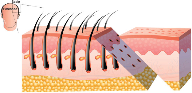 Figure 2