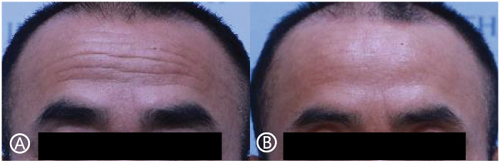 Figure 4