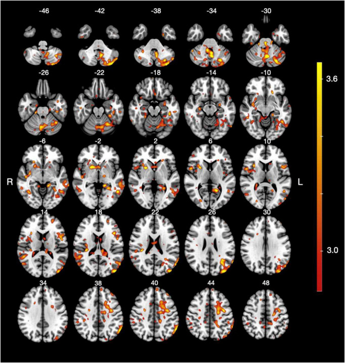FIGURE 3