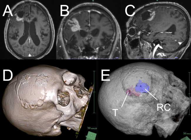Figure 1