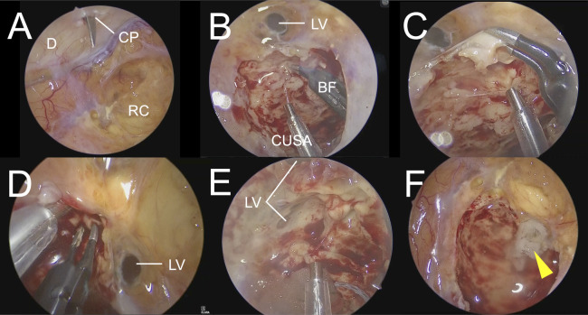 Figure 3