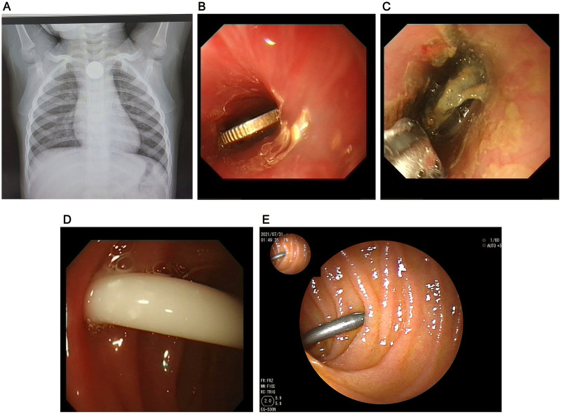 Figure 2
