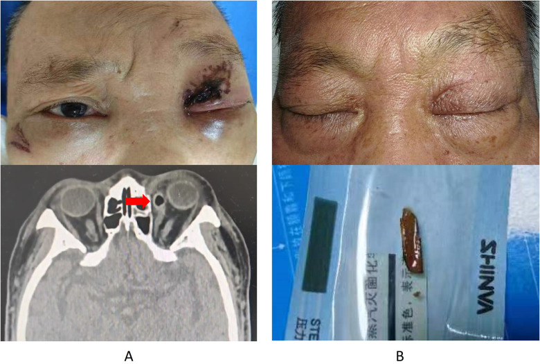 Figure 1