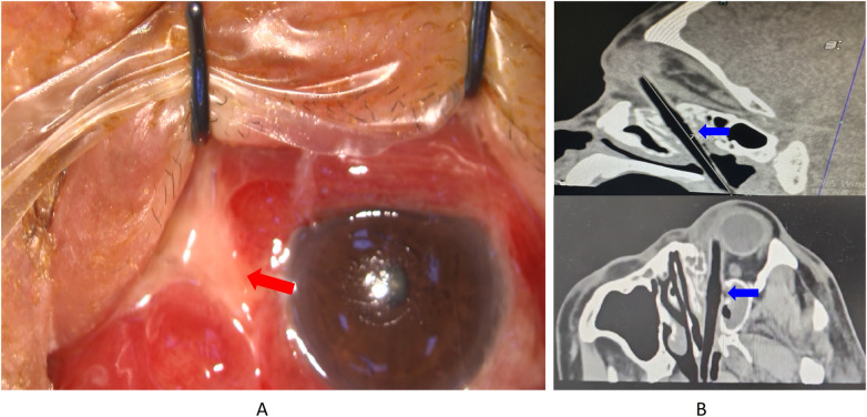 Figure 2