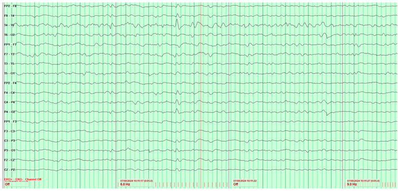 Figure 9