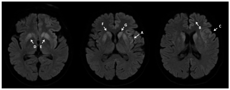 Figure 10