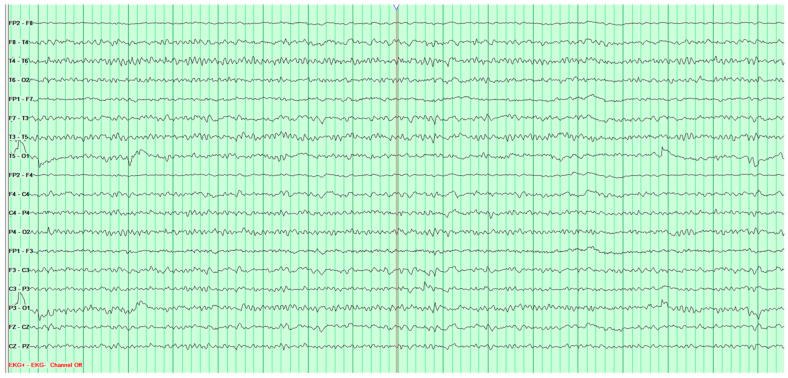 Figure 11