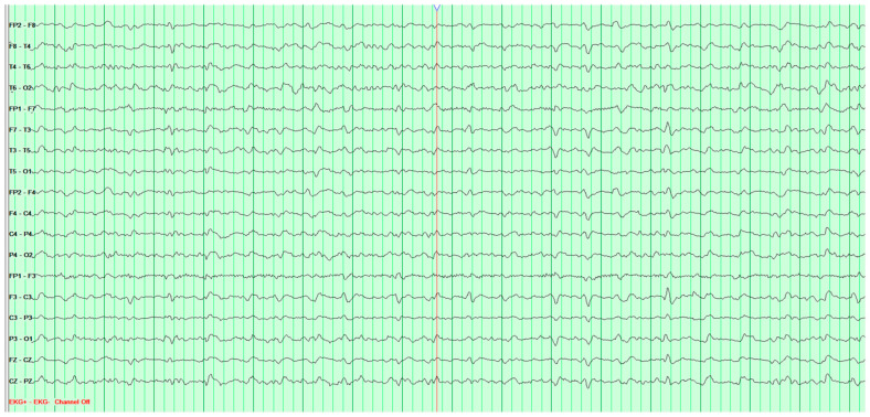 Figure 12